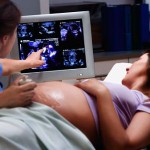 Когда во время беременности нужно проходить УЗИ?