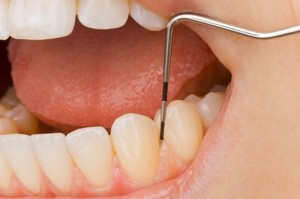 Беременность и зубная боль - обезбаливание: мази и препараты, лечение у стоматолога
